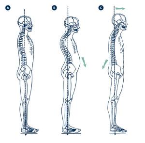 Como podemos ver, la postura correcta es la que alinea el cuerpo en un mismo eje.