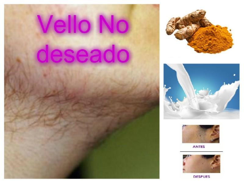 Vello en el rostro, remedio natural para eliminarlo