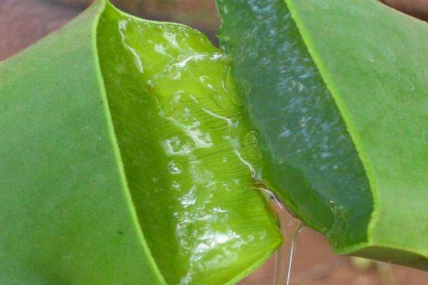 Elimina Los Queloides Con Remedios Naturales