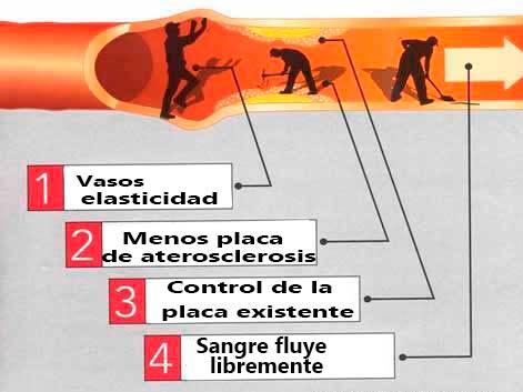 presión arterial alta