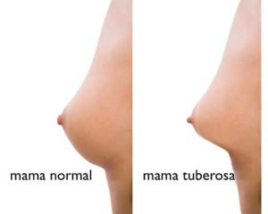 mamas hipoplasicas y normal Ciao Mamma
