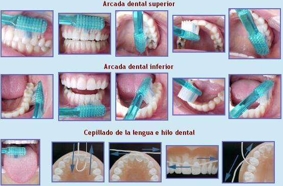 6 técnicas del cepillado, importante para la salud bucal