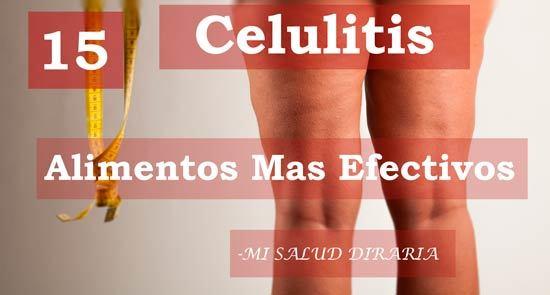 Celulitis