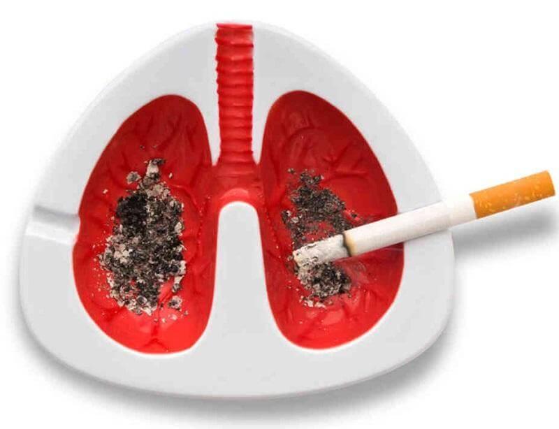 Cancer de Pulmon 1