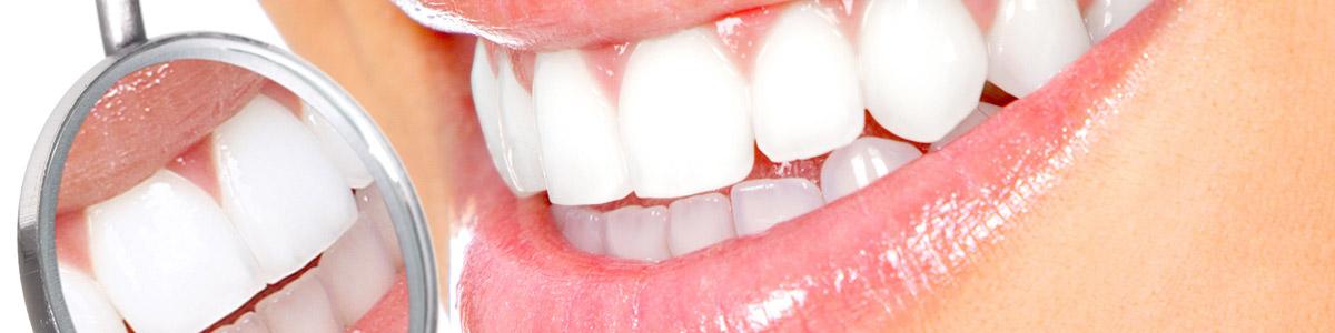 tips de belleza dientes