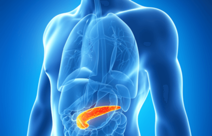 pancreatitis aguda