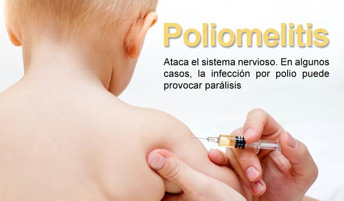 poliomelitis
