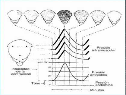 Distocias dinámicas. TGD