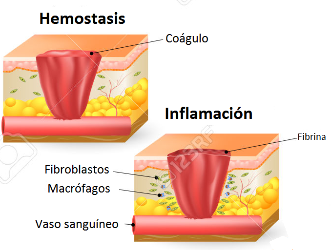 Cicatrización de heridas 5