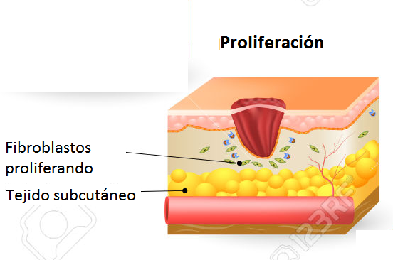 Cicatrización de heridas 6