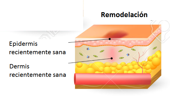 Cicatrización de heridas 7