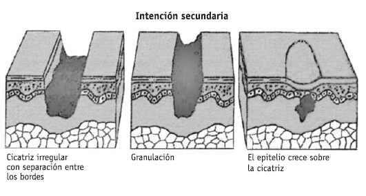 Cicatrización de heridas 3
