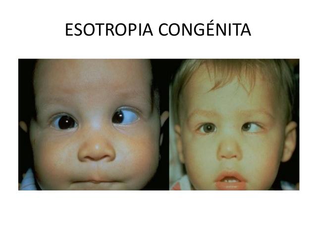 cribatge-ocular-55-638