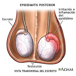enfermedades de trasmision sexual