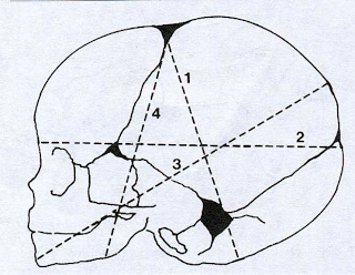 Estática fetal 4