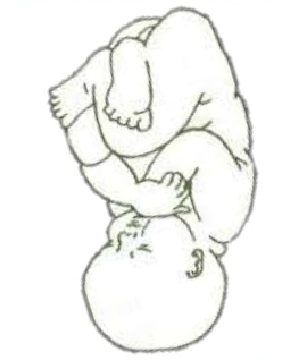Estática fetal 6