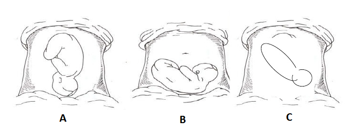 Estática fetal 7