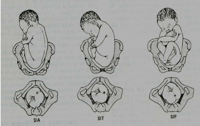 Estática fetal 10