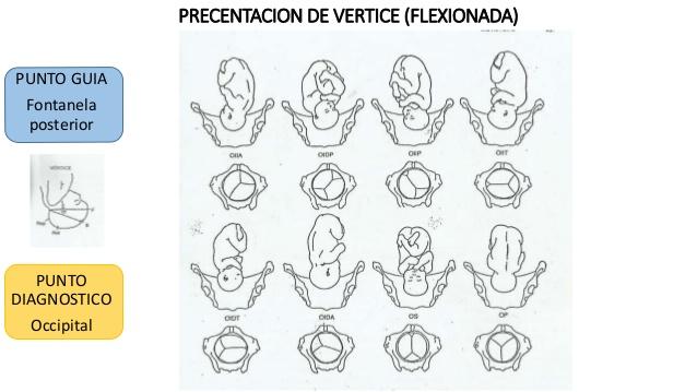 Estática fetal 9