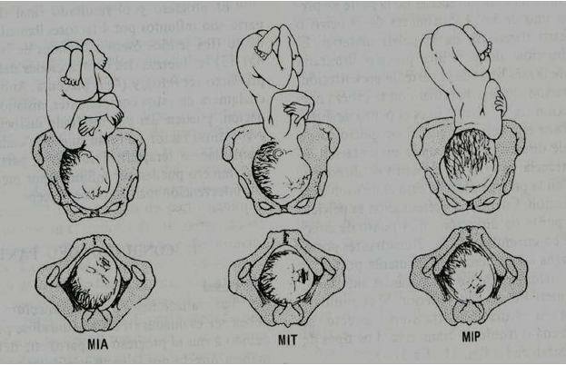 Estática fetal 13