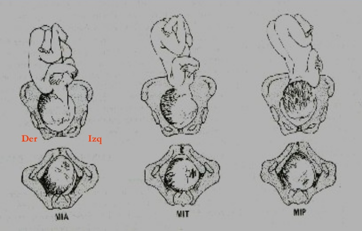 Estática fetal 12
