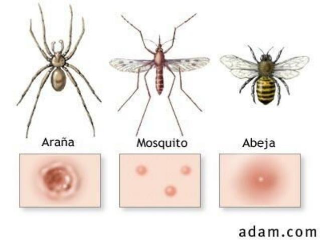 alergia