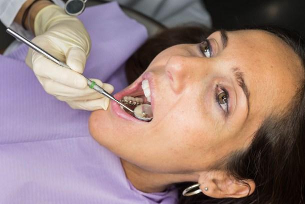4.AESOR_.-Paciente-ortodoncia-lingual