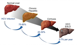tipos de hepatitis