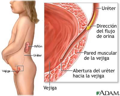 Infecciones urinarias en el embarazo 2