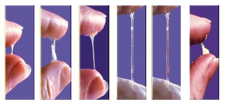 causas de infertilidad