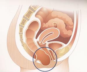 enfermedades anorrectales