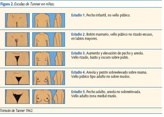 Pubertad precoz-Tanner