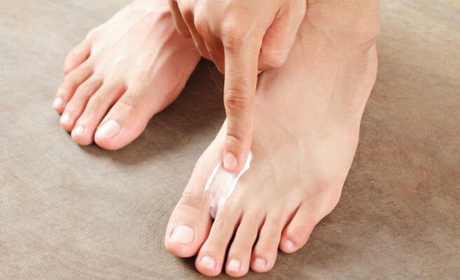 hongos en la piel complicaciones