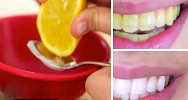blanquea los dientes en 2 minutos con estos ingredientes