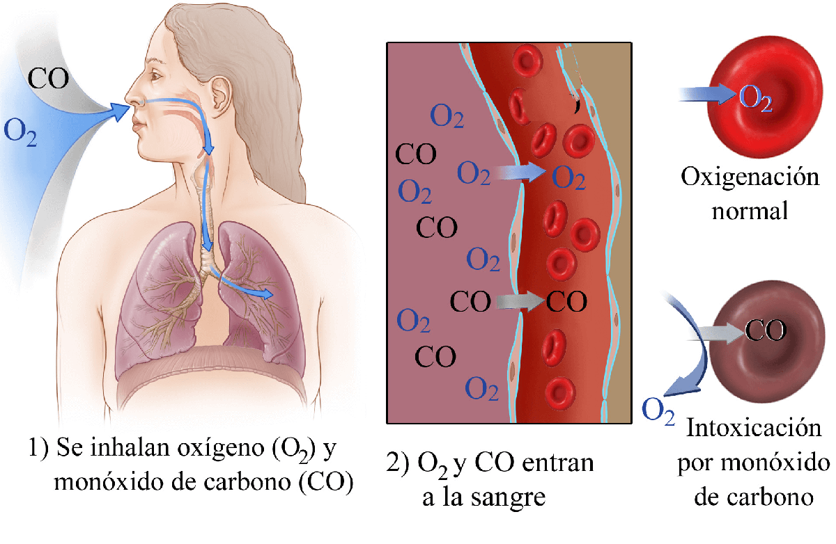 Daño en la inhalación de humo