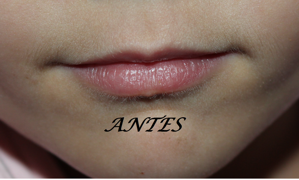 ANTES