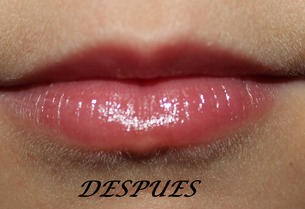 DESPUES