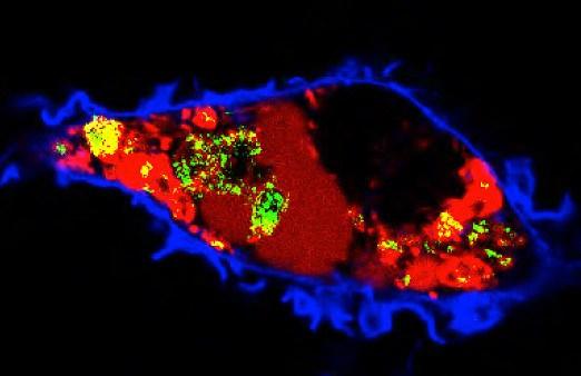 colesterol alimentación