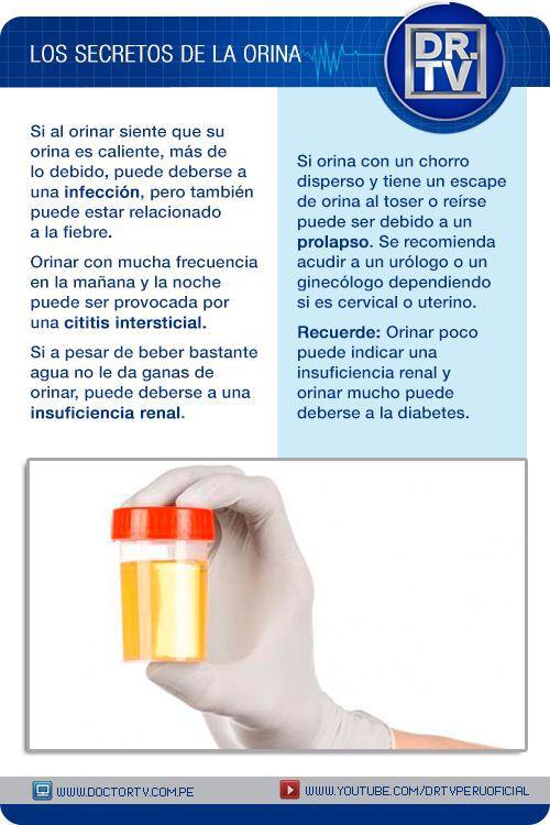 Secretos de la orina