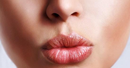 Beso