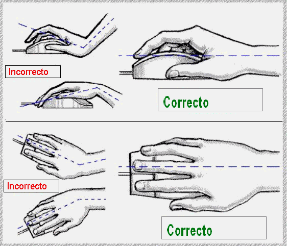 Tendinitis ordenador