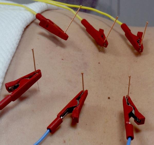 Electrolipolisis y presoterapia