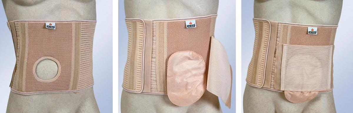 Fajas para colostomía e ileostomía