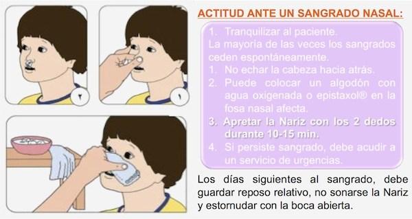 Resultado de imagen de sangrado de nariz que hay que hacer