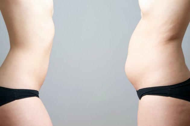 Remedios para la barriga hinchada: como reducirla