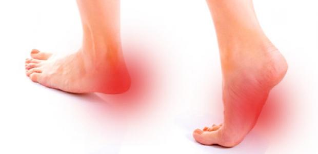 fascitis plantar