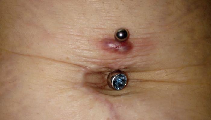 piercing infectado