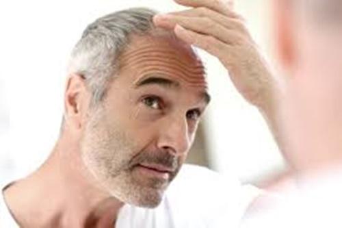 Cuidados del Cabello Frágil en hombres