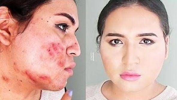 tips para las manchas en la cara