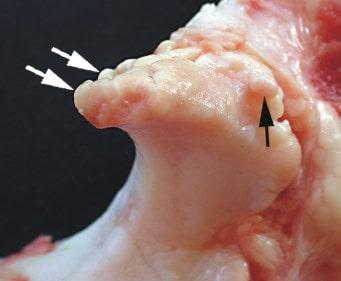 El envejecimiento es el mayor factor de riesgo para padecer de osteofitosis